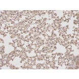 Immunohistochemistry - PTPN2 Antibody from Signalway Antibody (32444) - Antibodies.com