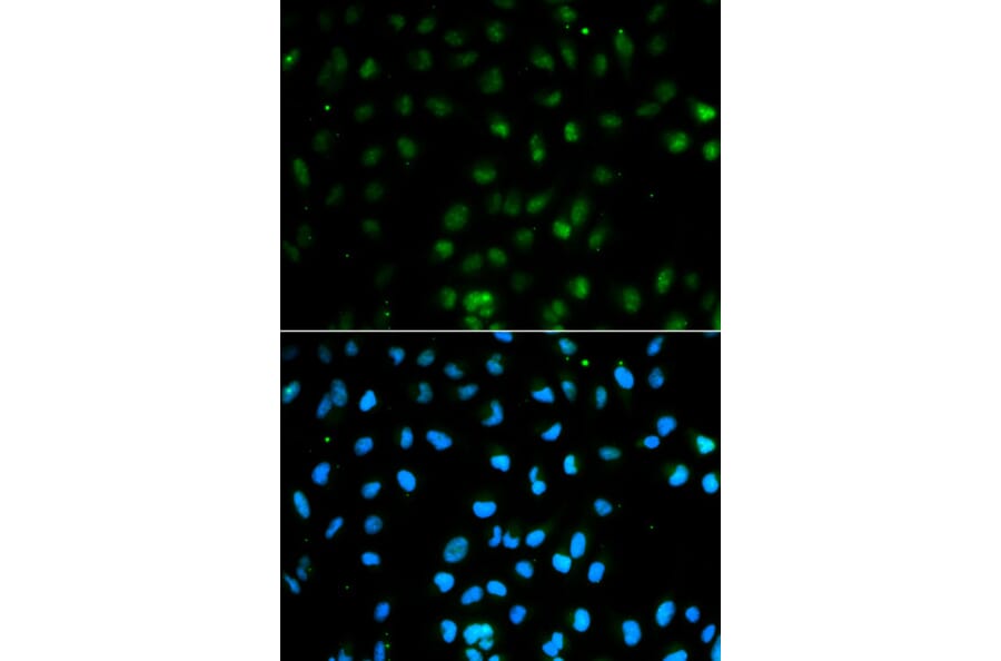 Immunofluorescence - PTPN2 Antibody from Signalway Antibody (32444) - Antibodies.com