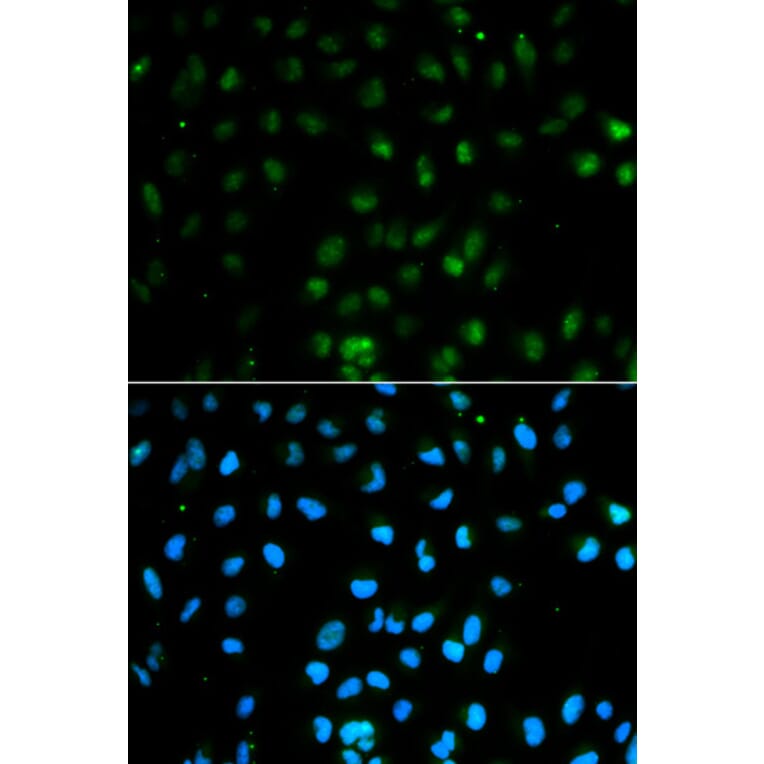 Immunofluorescence - PTPN2 Antibody from Signalway Antibody (32444) - Antibodies.com