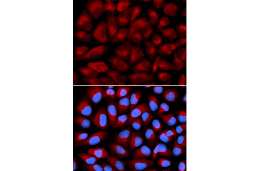 Immunofluorescence - FANCC Antibody from Signalway Antibody (32446) - Antibodies.com