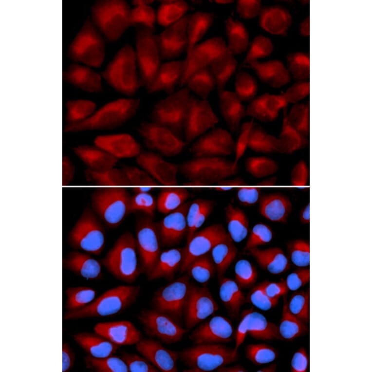 Immunofluorescence - FANCC Antibody from Signalway Antibody (32446) - Antibodies.com