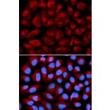 Immunofluorescence - FANCC Antibody from Signalway Antibody (32446) - Antibodies.com