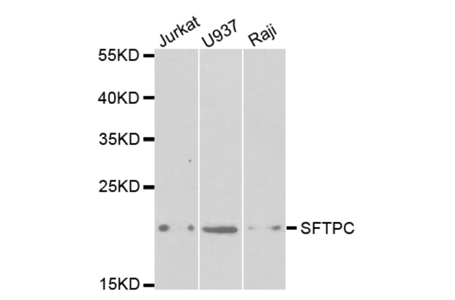 Western blot - SFTPC Antibody from Signalway Antibody (32459) - Antibodies.com