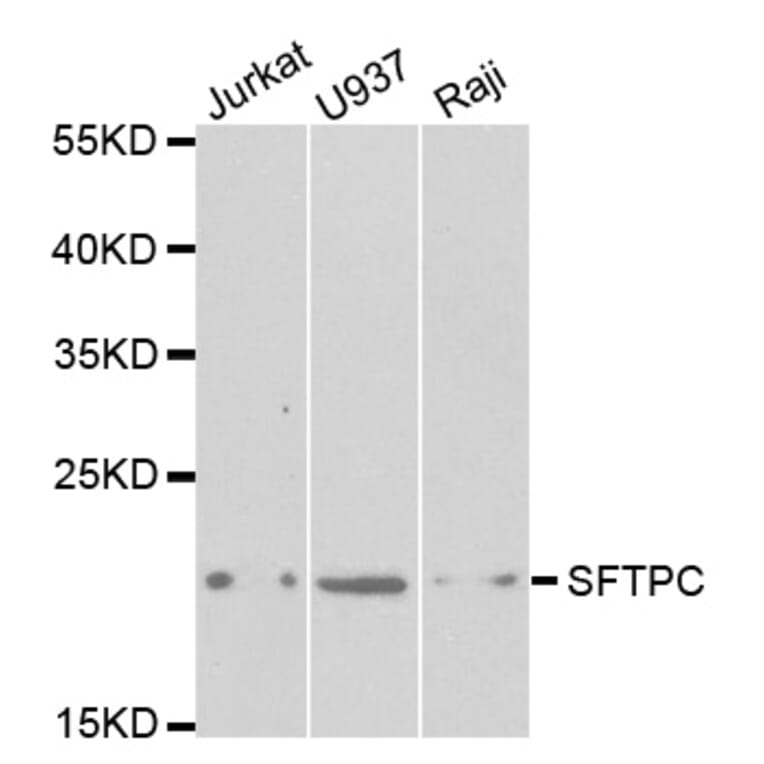 Western blot - SFTPC Antibody from Signalway Antibody (32459) - Antibodies.com