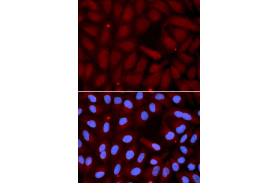 Immunofluorescence - SFTPC Antibody from Signalway Antibody (32459) - Antibodies.com