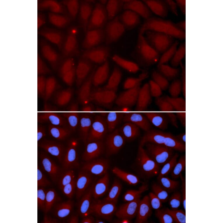 Immunofluorescence - SFTPC Antibody from Signalway Antibody (32459) - Antibodies.com