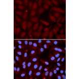 Immunofluorescence - SFTPC Antibody from Signalway Antibody (32459) - Antibodies.com