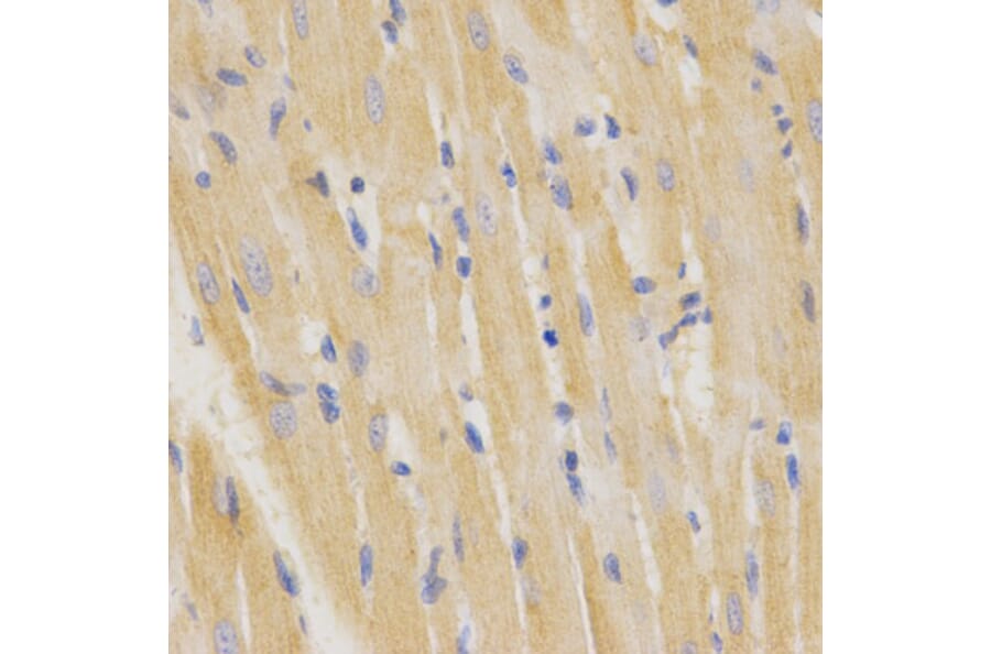 Immunohistochemistry - SFTPC Antibody from Signalway Antibody (32459) - Antibodies.com