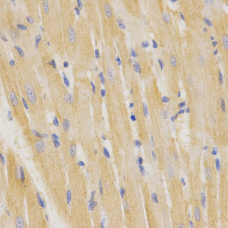 Immunohistochemistry - SFTPC Antibody from Signalway Antibody (32459) - Antibodies.com