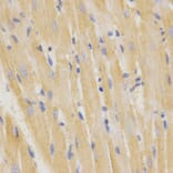 Immunohistochemistry - SFTPC Antibody from Signalway Antibody (32459) - Antibodies.com