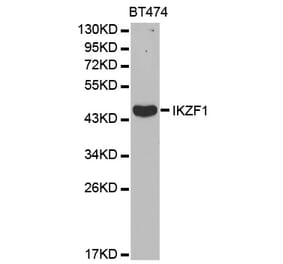 Western blot - IKZF1 Antibody from Signalway Antibody (32470) - Antibodies.com