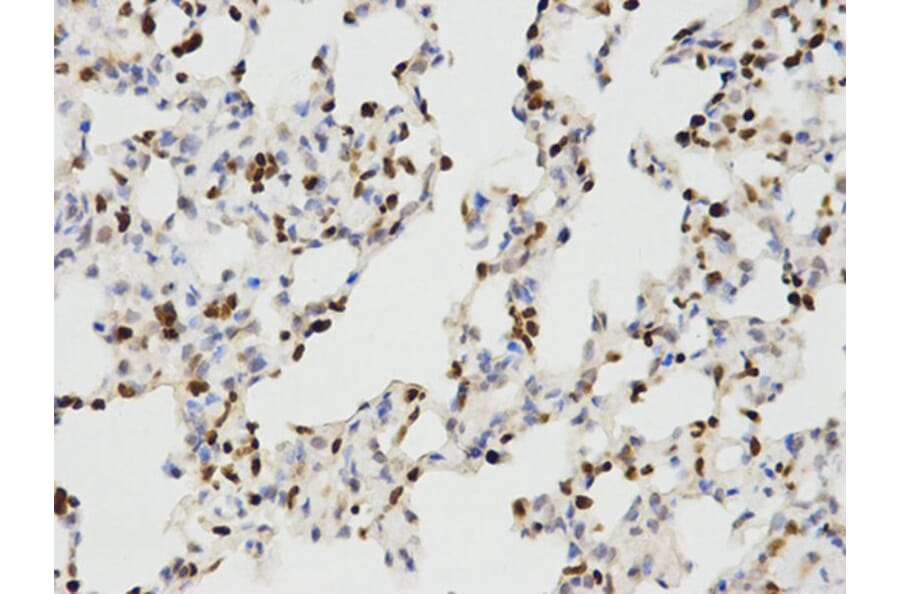 Immunohistochemistry - IKZF1 Antibody from Signalway Antibody (32470) - Antibodies.com