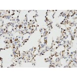 Immunohistochemistry - IKZF1 Antibody from Signalway Antibody (32470) - Antibodies.com