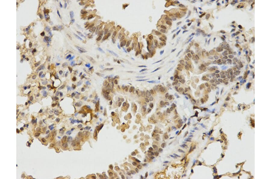Immunohistochemistry - IKZF1 Antibody from Signalway Antibody (32470) - Antibodies.com