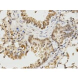 Immunohistochemistry - IKZF1 Antibody from Signalway Antibody (32470) - Antibodies.com