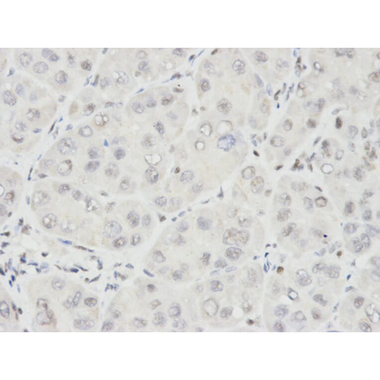 Immunohistochemistry - IKZF1 Antibody from Signalway Antibody (32470) - Antibodies.com