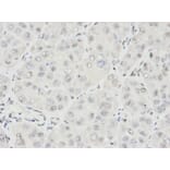 Immunohistochemistry - IKZF1 Antibody from Signalway Antibody (32470) - Antibodies.com