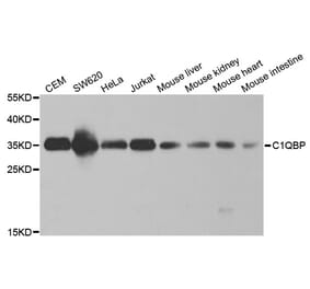 Western blot - C1QBP Antibody from Signalway Antibody (32485) - Antibodies.com