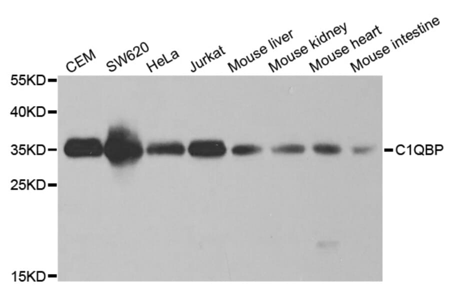 Western blot - C1QBP Antibody from Signalway Antibody (32485) - Antibodies.com