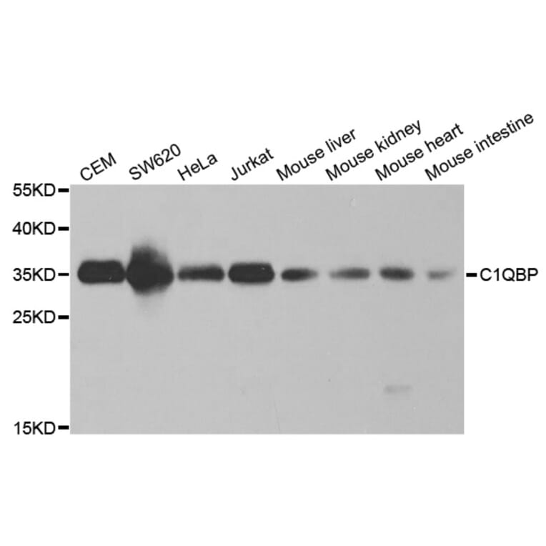 Western blot - C1QBP Antibody from Signalway Antibody (32485) - Antibodies.com