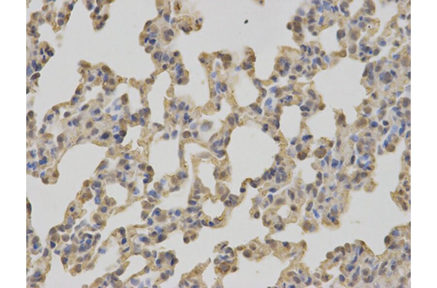 Immunohistochemistry - C1QBP Antibody from Signalway Antibody (32485) - Antibodies.com