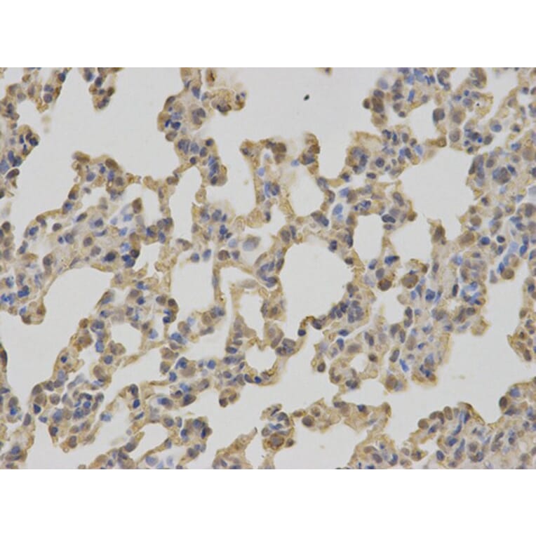 Immunohistochemistry - C1QBP Antibody from Signalway Antibody (32485) - Antibodies.com