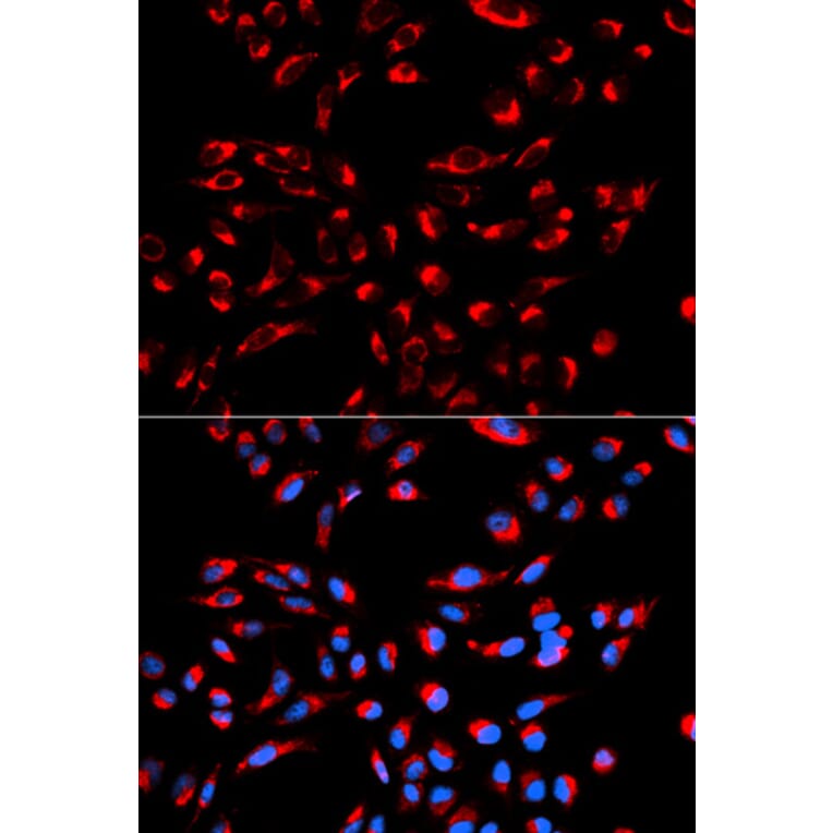 Immunofluorescence - C1QBP Antibody from Signalway Antibody (32485) - Antibodies.com