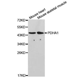 Western blot - PDHA1 Antibody from Signalway Antibody (32489) - Antibodies.com