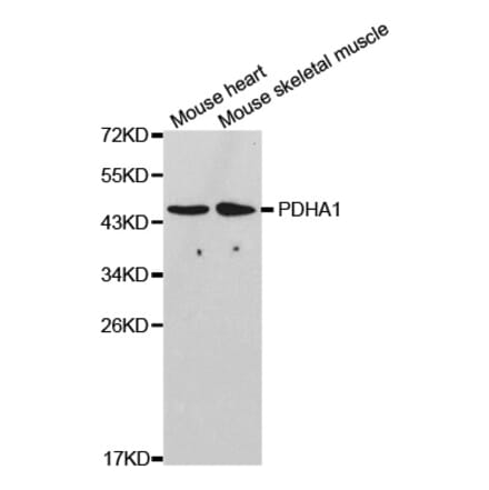 Western blot - PDHA1 Antibody from Signalway Antibody (32489) - Antibodies.com
