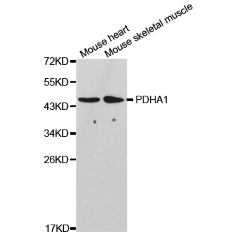 Western blot - PDHA1 Antibody from Signalway Antibody (32489) - Antibodies.com