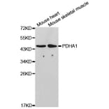Western blot - PDHA1 Antibody from Signalway Antibody (32489) - Antibodies.com