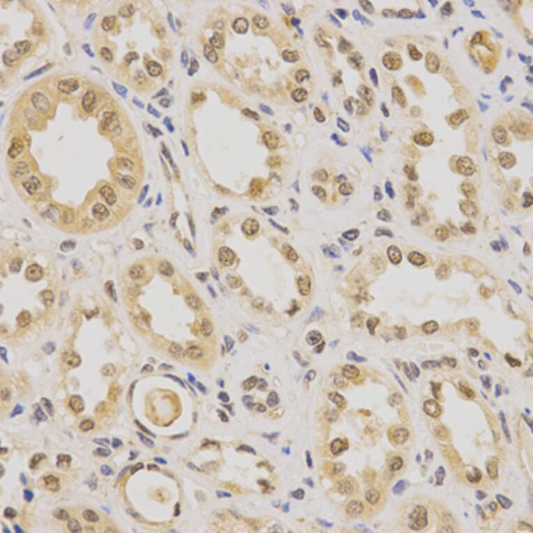 Immunohistochemistry - PDHA1 Antibody from Signalway Antibody (32489) - Antibodies.com