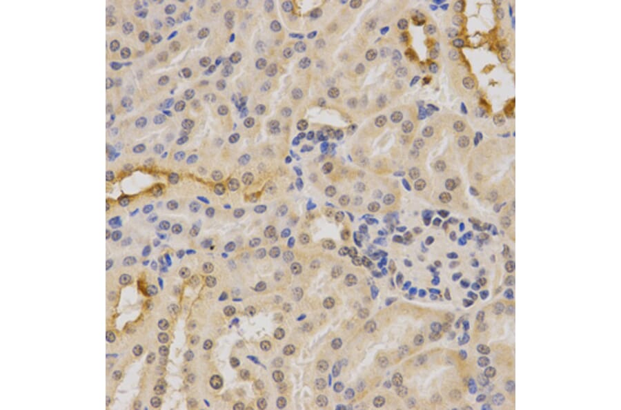 Immunohistochemistry - PDHA1 Antibody from Signalway Antibody (32489) - Antibodies.com