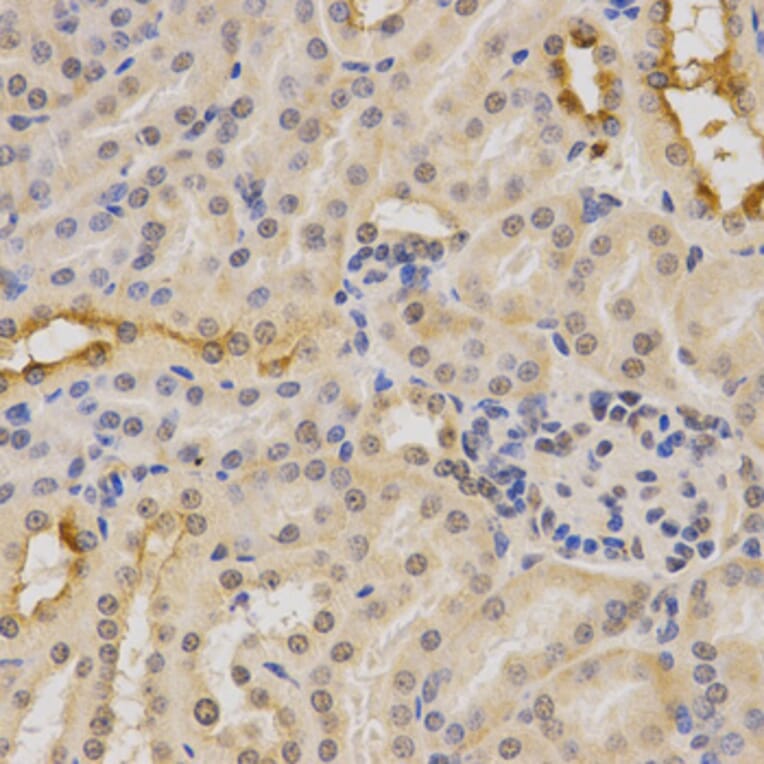 Immunohistochemistry - PDHA1 Antibody from Signalway Antibody (32489) - Antibodies.com
