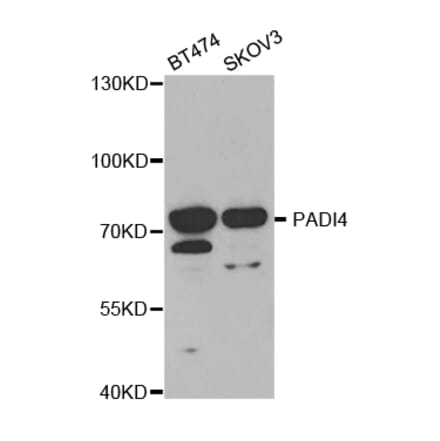 Western blot - PADI4 Antibody from Signalway Antibody (32493) - Antibodies.com
