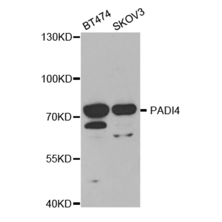Western blot - PADI4 Antibody from Signalway Antibody (32493) - Antibodies.com