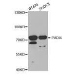 Western blot - PADI4 Antibody from Signalway Antibody (32493) - Antibodies.com