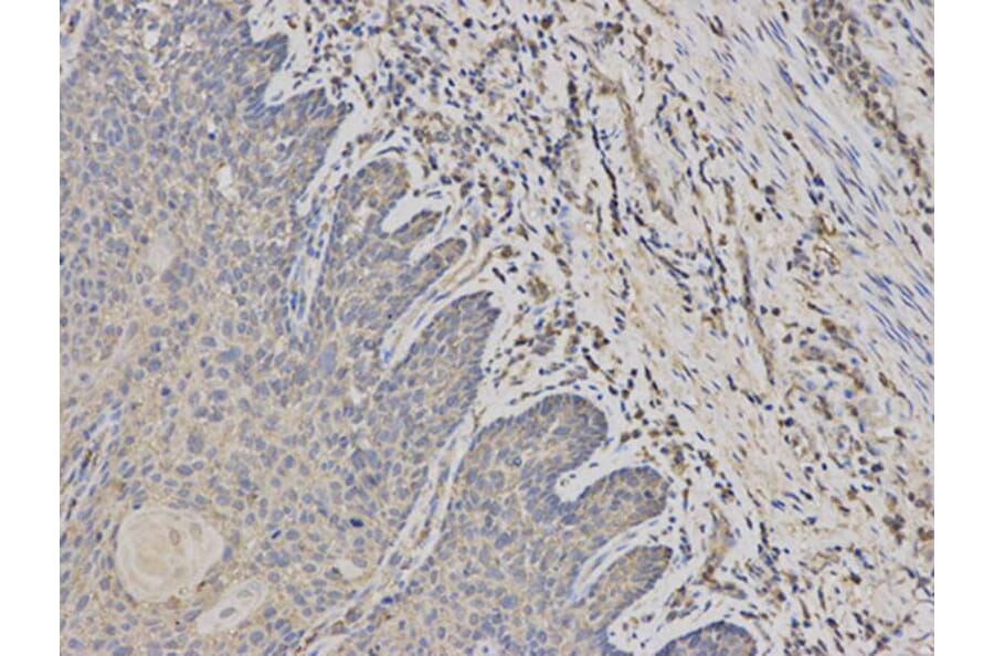 Immunohistochemistry - PADI4 Antibody from Signalway Antibody (32493) - Antibodies.com