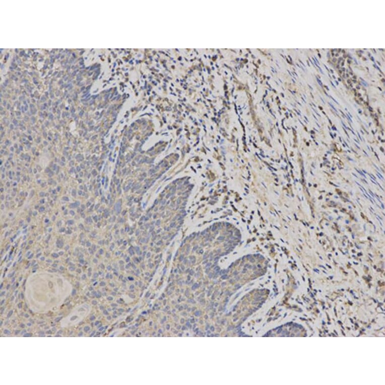 Immunohistochemistry - PADI4 Antibody from Signalway Antibody (32493) - Antibodies.com