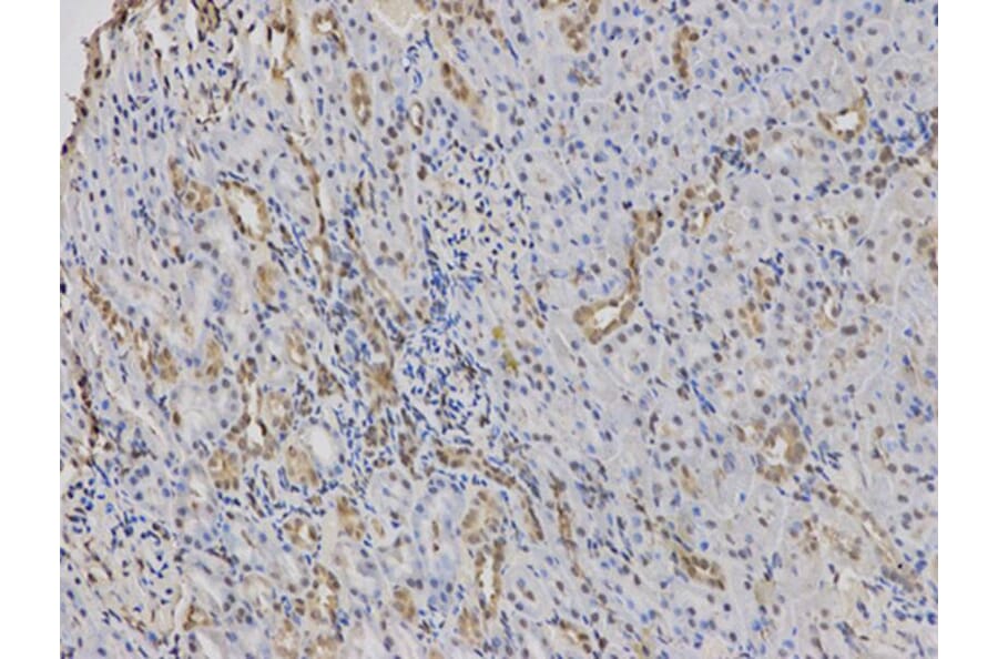 Immunohistochemistry - PADI4 Antibody from Signalway Antibody (32493) - Antibodies.com