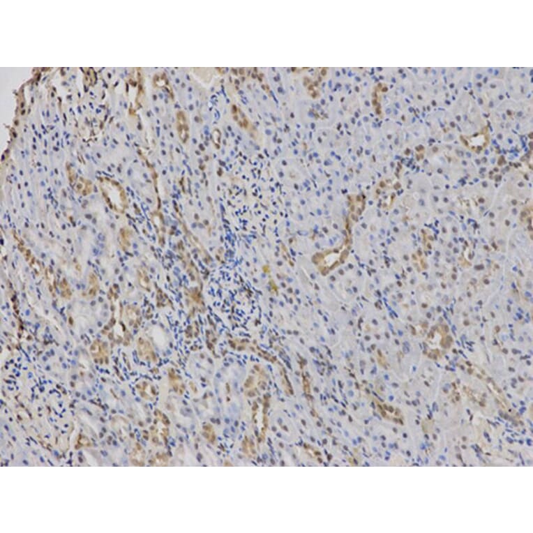 Immunohistochemistry - PADI4 Antibody from Signalway Antibody (32493) - Antibodies.com