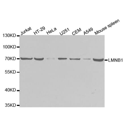 Western blot - LMNB1 Antibody from Signalway Antibody (32494) - Antibodies.com