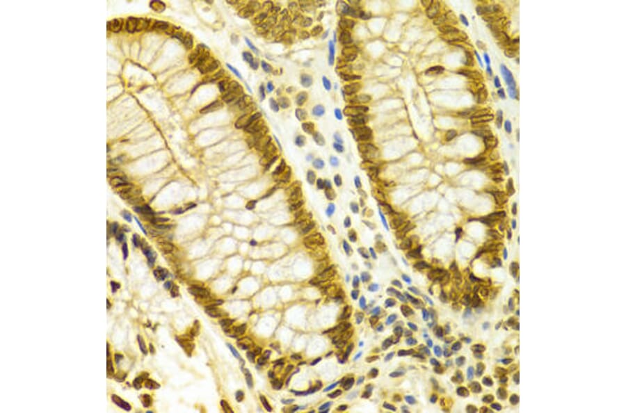 Immunohistochemistry - LMNB1 Antibody from Signalway Antibody (32494) - Antibodies.com