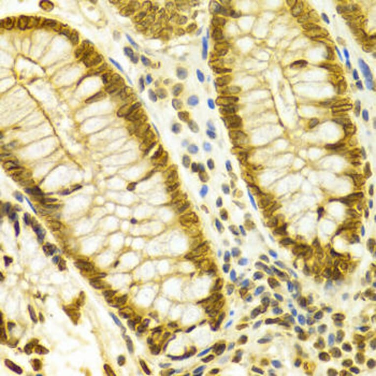 Immunohistochemistry - LMNB1 Antibody from Signalway Antibody (32494) - Antibodies.com