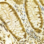 Immunohistochemistry - LMNB1 Antibody from Signalway Antibody (32494) - Antibodies.com