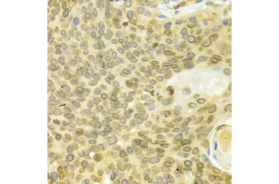 Immunohistochemistry - LMNB1 Antibody from Signalway Antibody (32494) - Antibodies.com