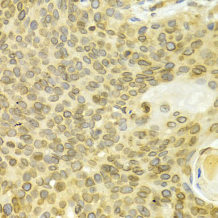 Immunohistochemistry - LMNB1 Antibody from Signalway Antibody (32494) - Antibodies.com