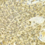 Immunohistochemistry - LMNB1 Antibody from Signalway Antibody (32494) - Antibodies.com