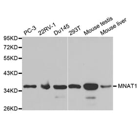 Western blot - MNAT1 Antibody from Signalway Antibody (32496) - Antibodies.com