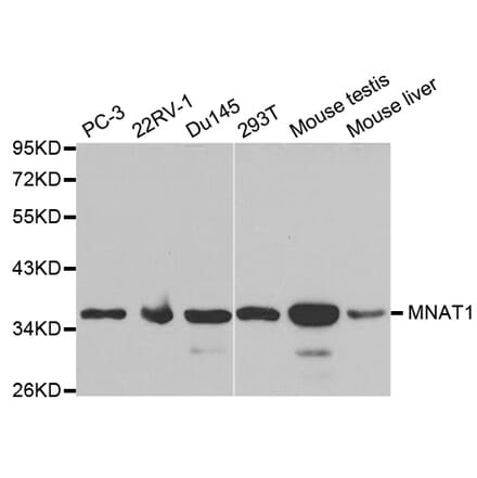 Western blot - MNAT1 Antibody from Signalway Antibody (32496) - Antibodies.com